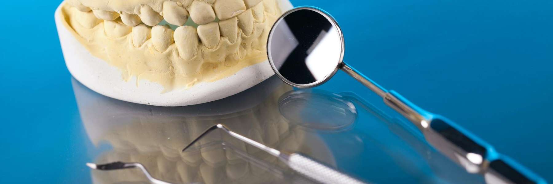A dental impression of a Root Canal Treatment in Edmond, OK