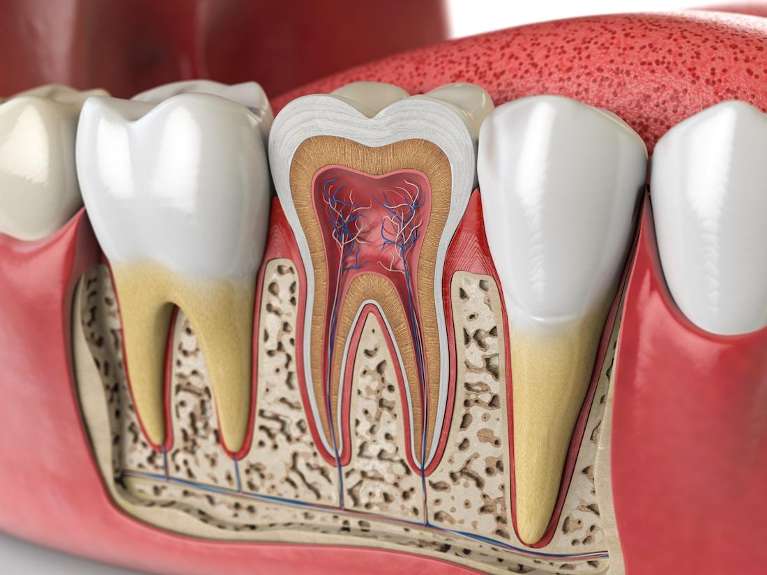 An illustration of a root canal in Edmond, OK