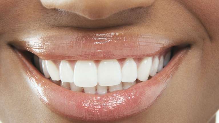 A patient smiling after getting dental implant at Edmond dentist, Edmond OK