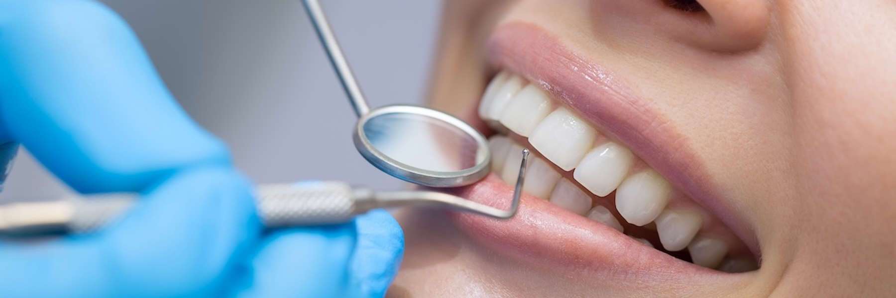 Tools used in a Cosmetic Dentistry treatment in Edmond, OK