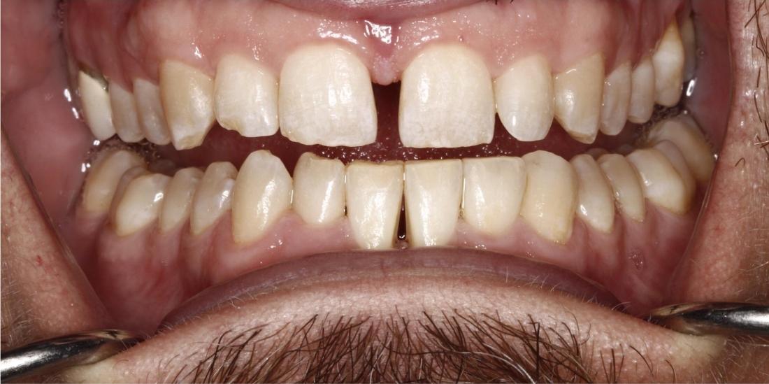 Results after periodontal treatment in Edmond, OK